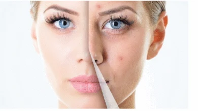 شیر پرچرب و تشدید آلرژیهای پوستی نوجوانان شیر پرچرب و تشدید آلرژیهای پوستی نوجوانان